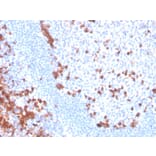 Immunohistochemistry - Anti-B7-H6 Antibody [B7H6/4821] (A249102) - Antibodies.com