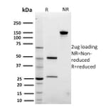 SDS-PAGE - Anti-ARF1 Antibody [3F1] (A249103) - Antibodies.com