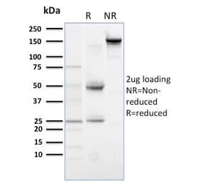 SDS-PAGE - Anti-PLK1 Antibody [AZ44] (A249105) - Antibodies.com