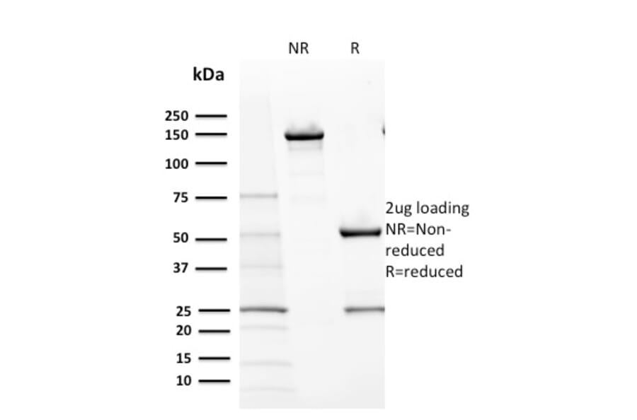 SDS-PAGE - Anti-c-Kit Antibody [KIT/2670] (A249108) - Antibodies.com
