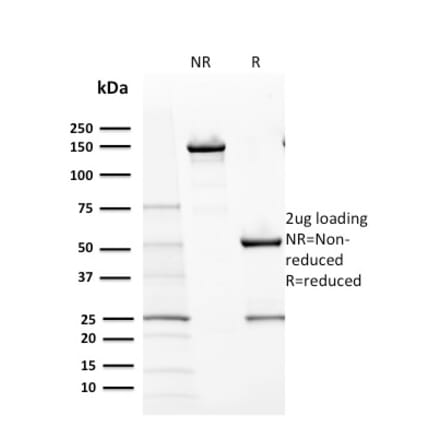SDS-PAGE - Anti-c-Kit Antibody [KIT/2670] (A249108) - Antibodies.com