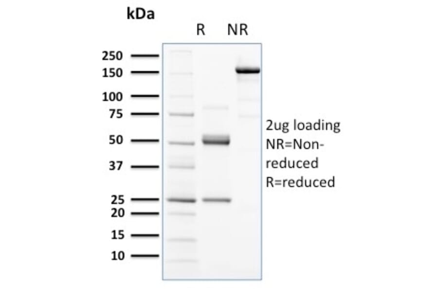 SDS-PAGE - Anti-c-Kit Antibody [KIT/2672] (A249109) - Antibodies.com
