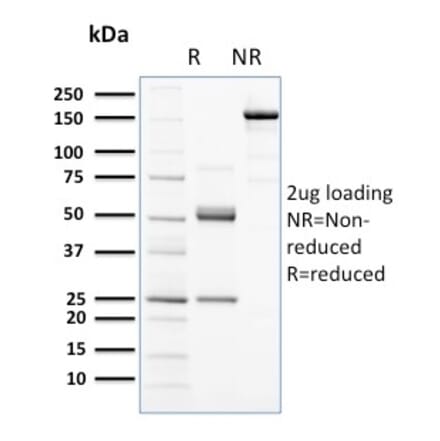 SDS-PAGE - Anti-c-Kit Antibody [KIT/2672] (A249109) - Antibodies.com