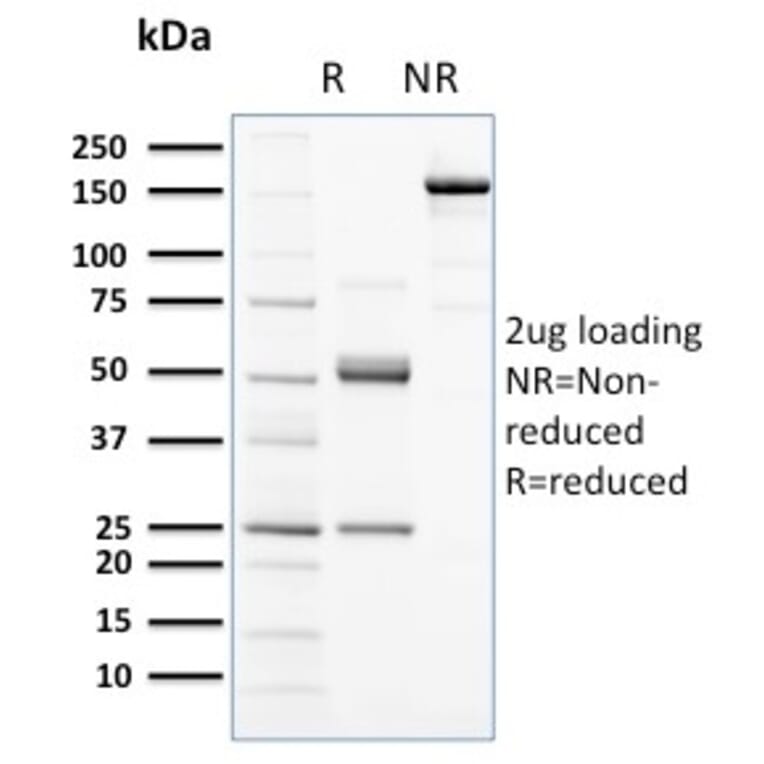 SDS-PAGE - Anti-c-Kit Antibody [KIT/2672] (A249109) - Antibodies.com