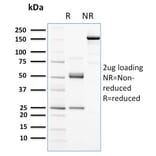 SDS-PAGE - Anti-c-Kit Antibody [KIT/2672] (A249109) - Antibodies.com