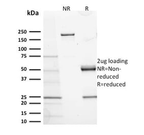 SDS-PAGE - Anti-c-Kit Antibody [KIT/2673] (A249110) - Antibodies.com