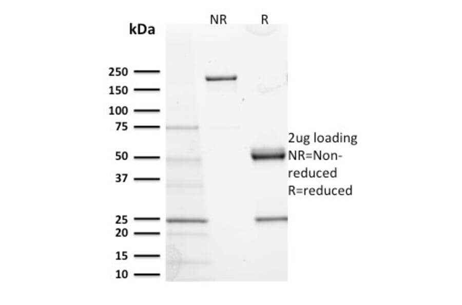 SDS-PAGE - Anti-c-Kit Antibody [KIT/2673] (A249110) - Antibodies.com
