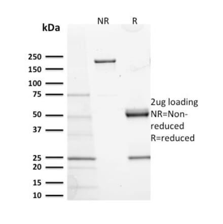 SDS-PAGE - Anti-c-Kit Antibody [KIT/2673] (A249110) - Antibodies.com