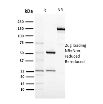 SDS-PAGE - Anti-c-Kit Antibody [KIT/2674] (A249111) - Antibodies.com