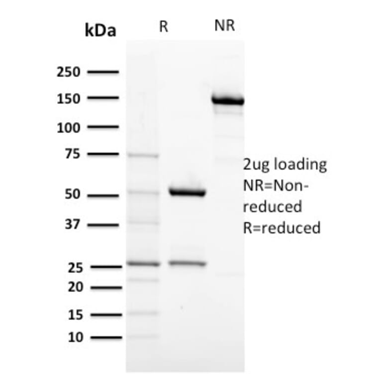 SDS-PAGE - Anti-c-Kit Antibody [KIT/2674] (A249111) - Antibodies.com