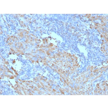Immunohistochemistry - Anti-c-Kit Antibody [C117/370] (A249112) - Antibodies.com
