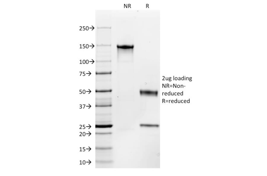SDS-PAGE - Anti-c-Kit Antibody [C117/370] (A249112) - Antibodies.com