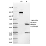 SDS-PAGE - Anti-c-Kit Antibody [C117/370] (A249112) - Antibodies.com