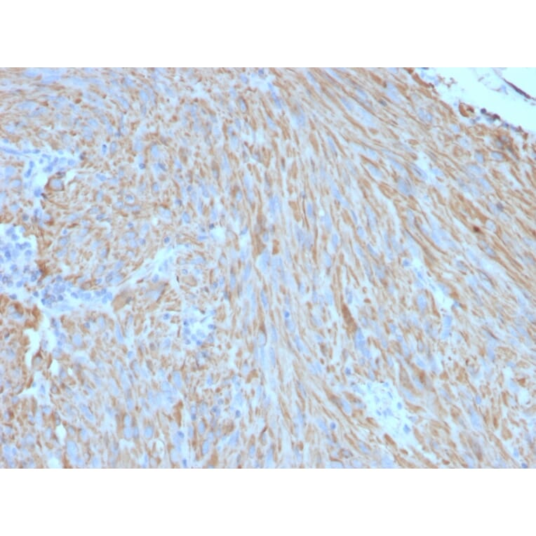 Immunohistochemistry - Anti-c-Kit Antibody [C117/370] (A249111) - Antibodies.com