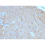 Immunohistochemistry - Anti-c-Kit Antibody [C117/370] (A249111) - Antibodies.com