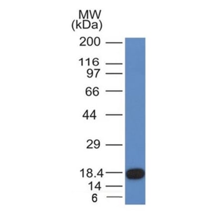 Western Blot - Anti-c-Kit Antibody [KIT/982] (A249113) - Antibodies.com