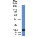 Western Blot - Anti-c-Kit Antibody [KIT/983] (A249114) - Antibodies.com