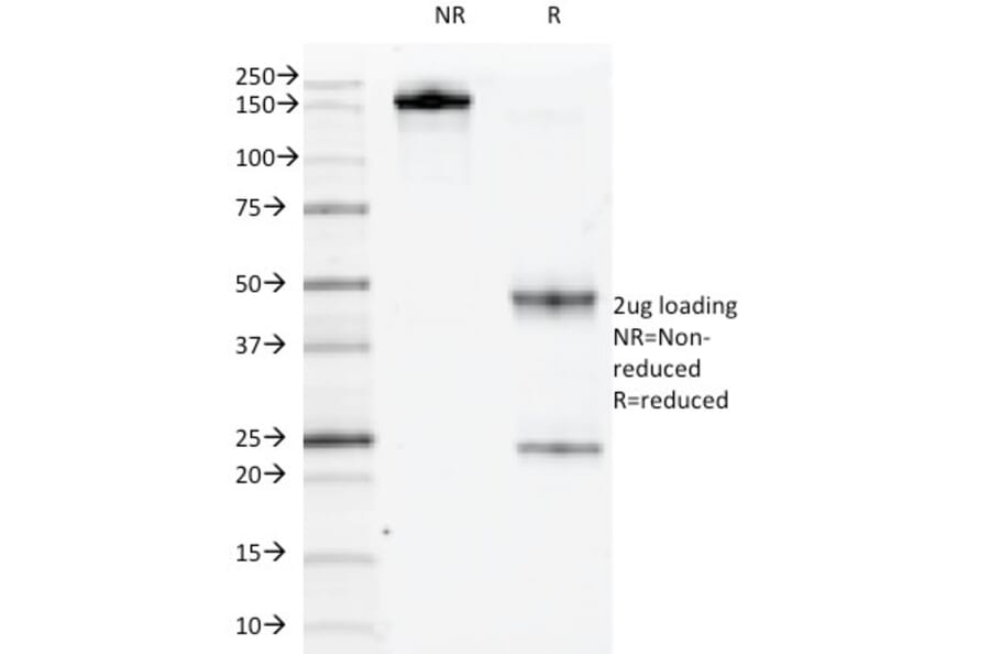 SDS-PAGE - Anti-c-Kit Antibody [KIT/983] (A249113) - Antibodies.com