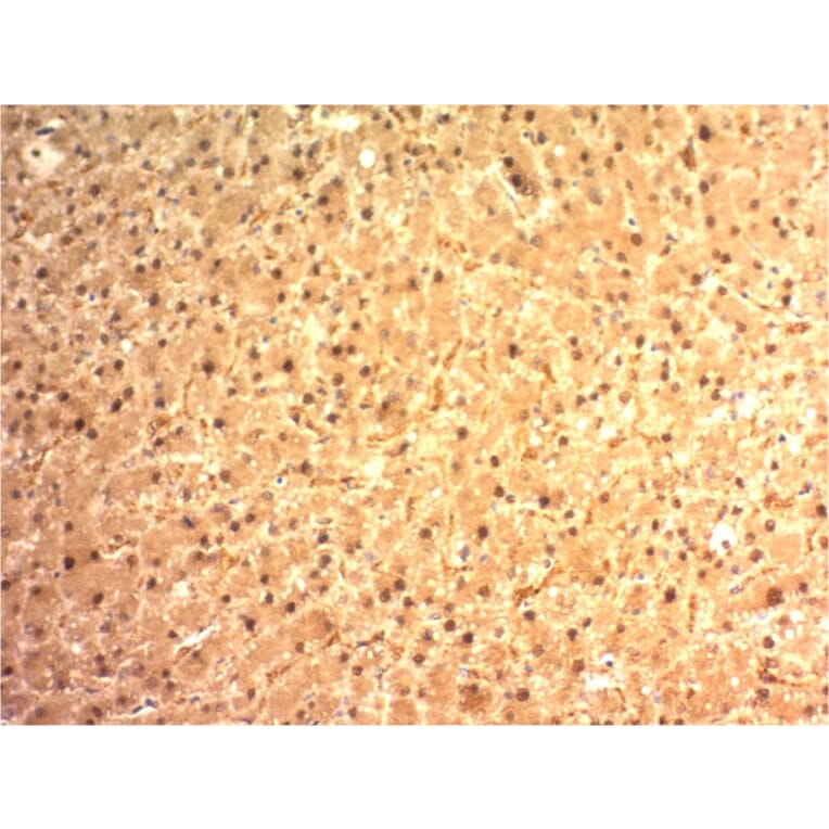 Immunohistochemistry - Anti-Arginase 1 Antibody [ARG1/1125] (A249116) - Antibodies.com