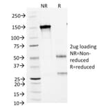 SDS-PAGE - Anti-Arginase 1 Antibody [ARG1/1125] (A249116) - Antibodies.com