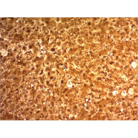 Immunohistochemistry - Anti-Arginase 1 Antibody [ARG1/1126] (A249117) - Antibodies.com