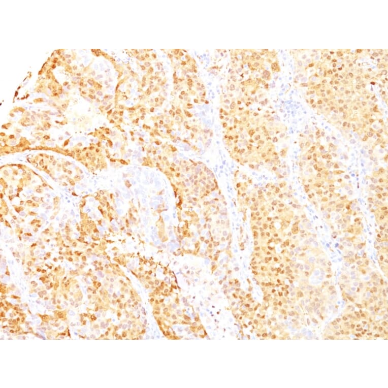 Immunohistochemistry - Anti-Arginase 1 Antibody [ARG1/1125+ ARG1/1126] (A249117) - Antibodies.com