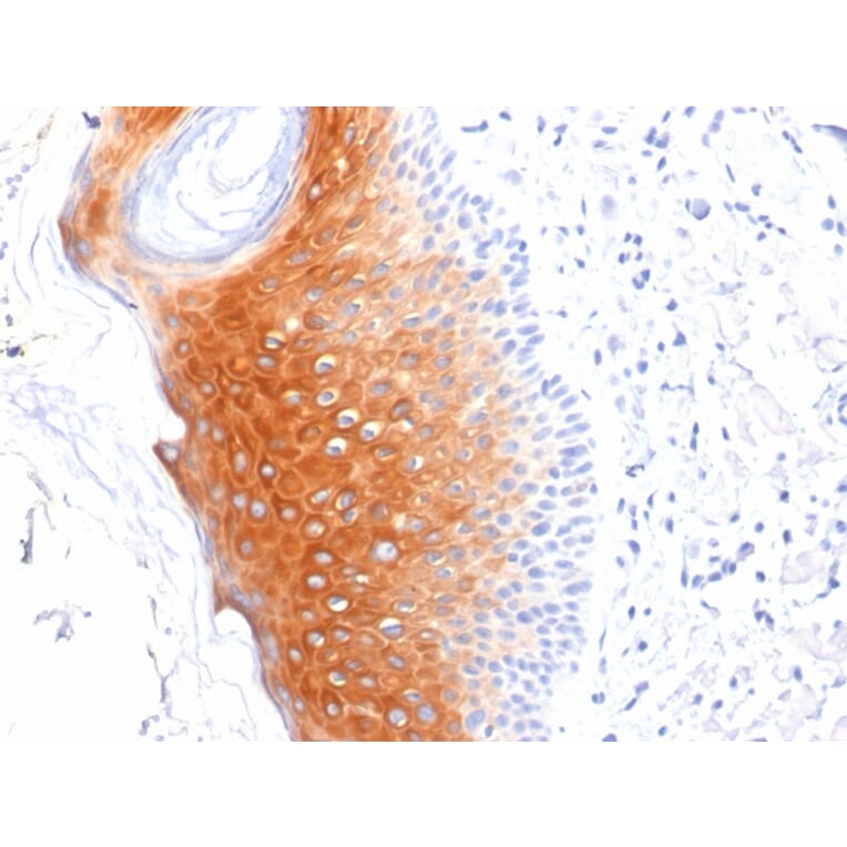 Immunohistochemistry - Anti-Cytokeratin 1 Antibody [LHK1] (A249119) - Antibodies.com