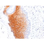 Immunohistochemistry - Anti-Cytokeratin 1 Antibody [LHK1] (A249119) - Antibodies.com