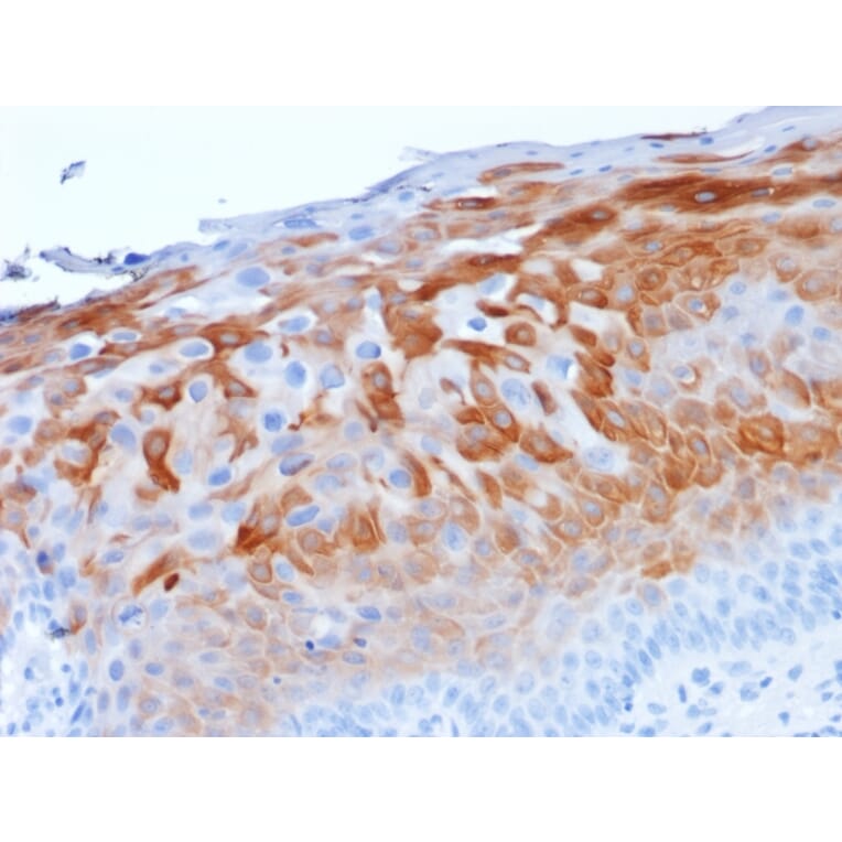 Immunohistochemistry - Anti-Cytokeratin 1 Antibody [LHK1] (A249118) - Antibodies.com