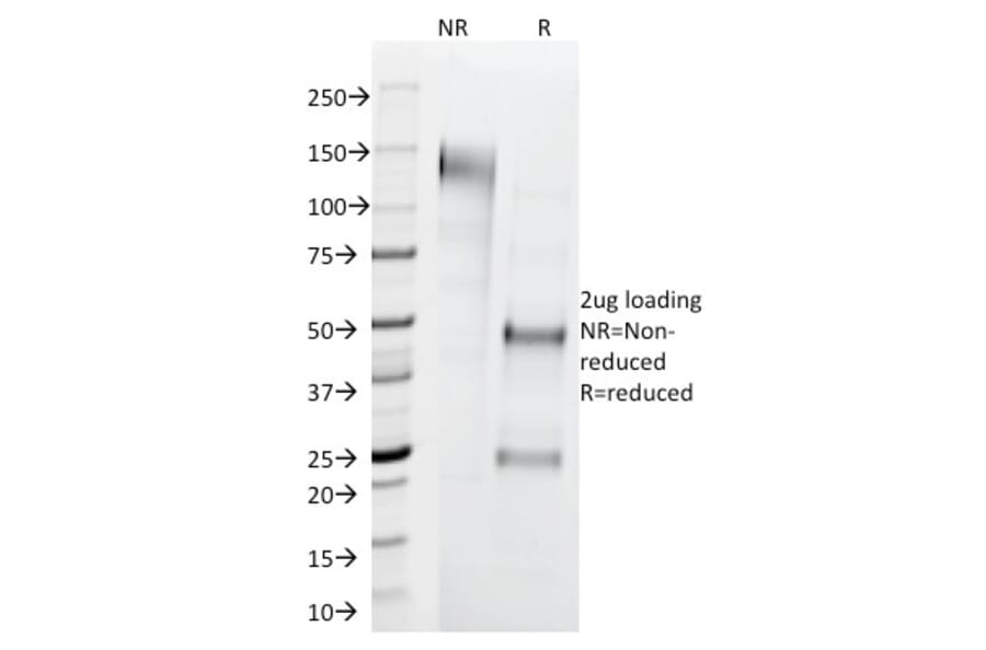 SDS-PAGE - Anti-Cytokeratin 1 Antibody [LHK1] (A249119) - Antibodies.com