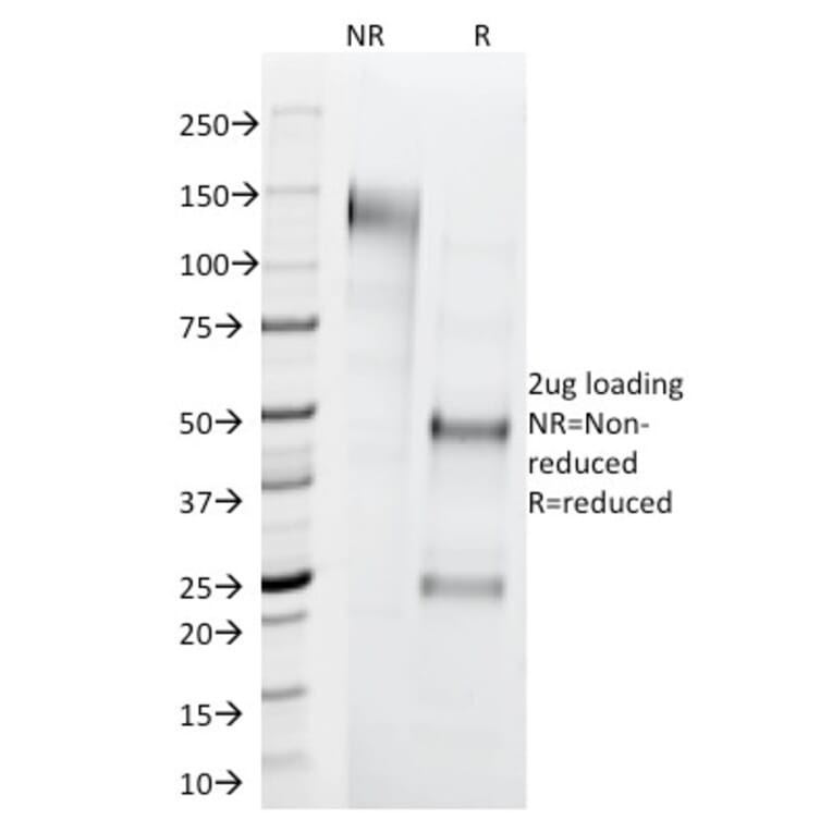 SDS-PAGE - Anti-Cytokeratin 1 Antibody [LHK1] (A249119) - Antibodies.com