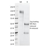 SDS-PAGE - Anti-Cytokeratin 1 Antibody [LHK1] (A249119) - Antibodies.com