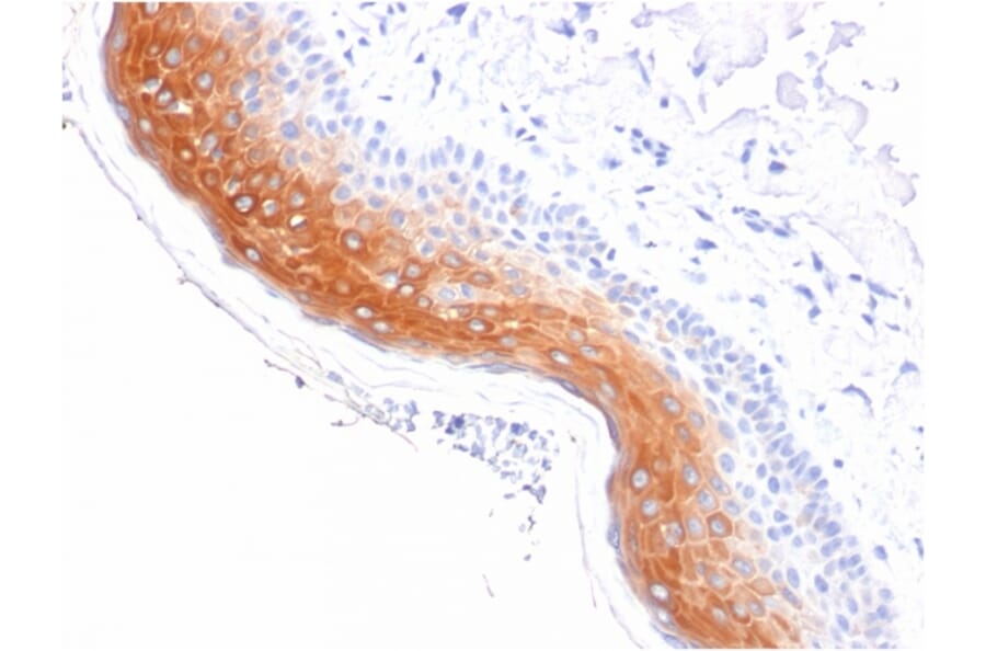 Immunohistochemistry - Anti-Cytokeratin 1 Antibody [KRT1/1840] (A249120) - Antibodies.com