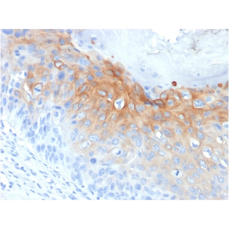 Immunohistochemistry - Anti-Cytokeratin 1 Antibody [KRT1/1840] (A249119) - Antibodies.com