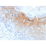 Immunohistochemistry - Anti-Cytokeratin 1 Antibody [KRT1/1840] (A249119) - Antibodies.com