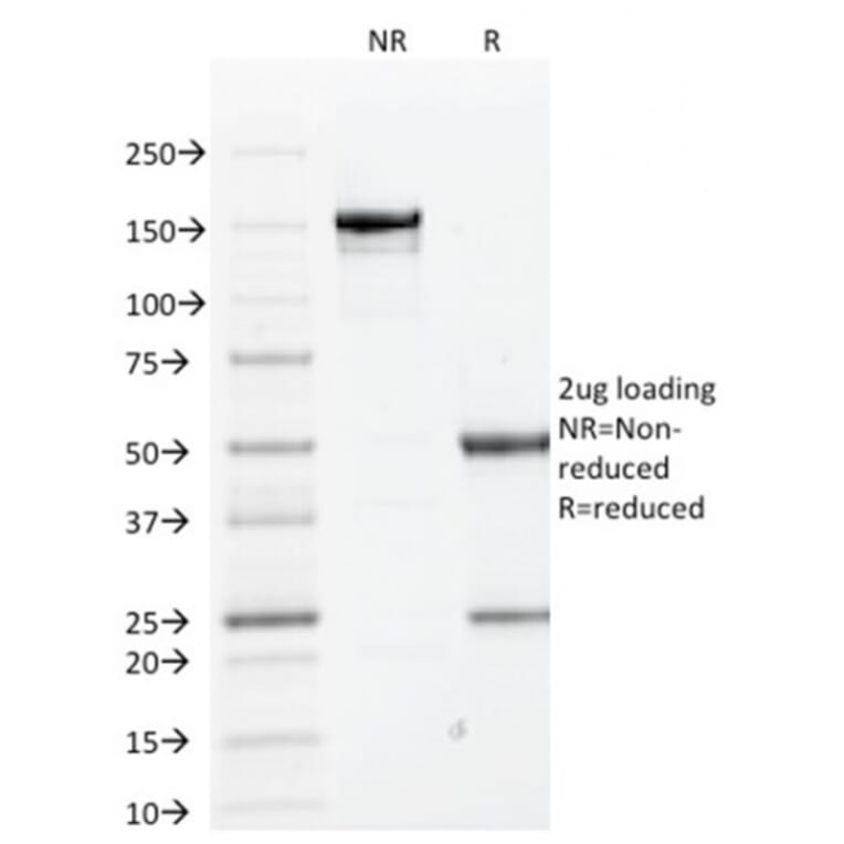 SDS-PAGE - Anti-Cytokeratin 1 Antibody [KRT1/1840] (A249120) - Antibodies.com