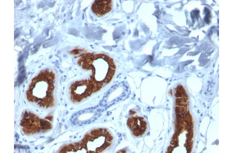 Immunohistochemistry - Anti-Cytokeratin 3 Antibody [KRT3/2130] (A249121) - Antibodies.com