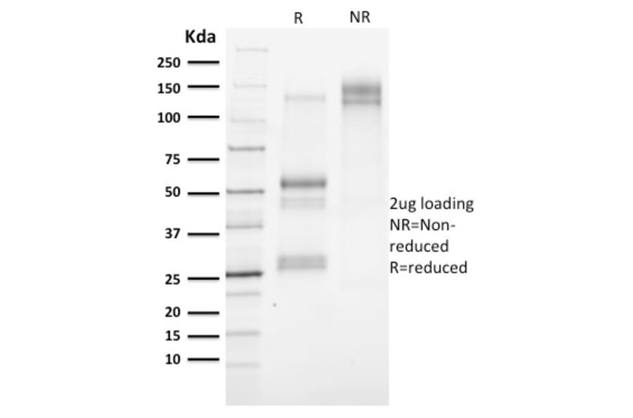 SDS-PAGE - Anti-Cytokeratin 3 Antibody [KRT3/2130] (A249121) - Antibodies.com