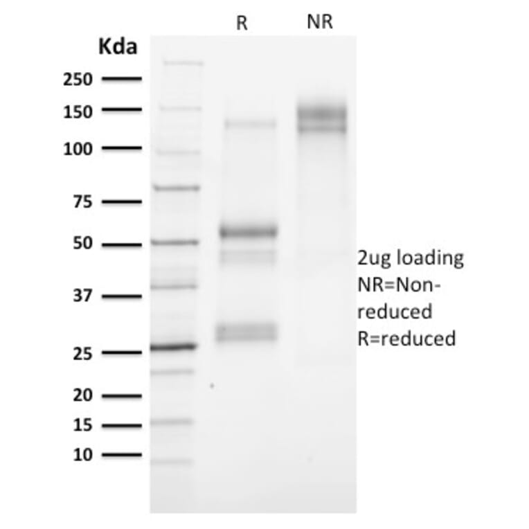 SDS-PAGE - Anti-Cytokeratin 3 Antibody [KRT3/2130] (A249121) - Antibodies.com