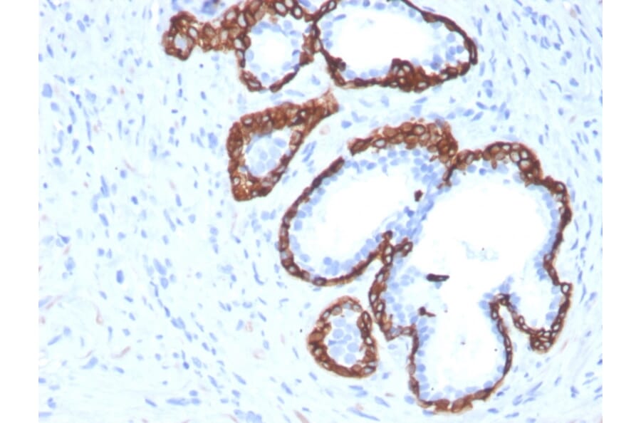 Immunohistochemistry - Anti-Cytokeratin 5 Antibody [KRT5/3594] (A249124) - Antibodies.com
