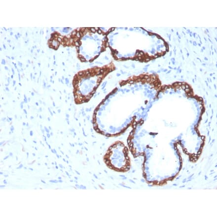 Immunohistochemistry - Anti-Cytokeratin 5 Antibody [KRT5/3594] (A249124) - Antibodies.com