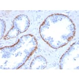 Immunohistochemistry - Anti-Cytokeratin 5 Antibody [KRT5/3594] (A249124) - Antibodies.com