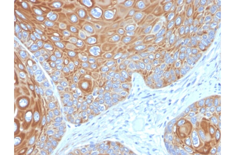 Immunohistochemistry - Anti-Cytokeratin 5 Antibody [KRT5/3594] (A249124) - Antibodies.com