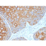 Immunohistochemistry - Anti-Cytokeratin 5 Antibody [KRT5/3594] (A249124) - Antibodies.com