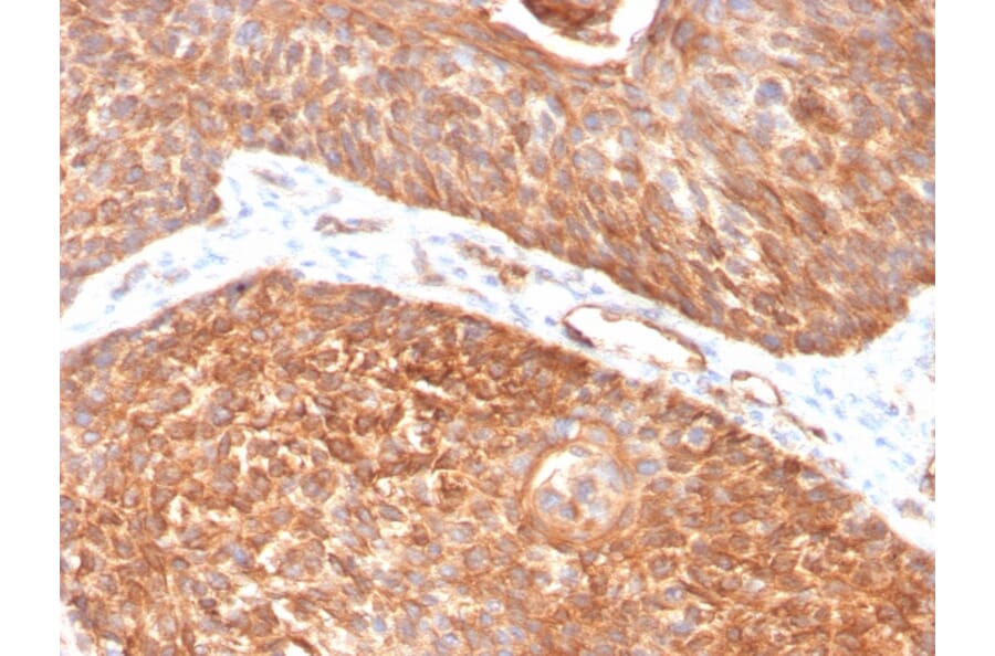 Immunohistochemistry - Anti-Cytokeratin 5 Antibody [KRT5/3594] (A249124) - Antibodies.com
