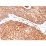 Immunohistochemistry - Anti-Cytokeratin 5 Antibody [KRT5/3594] (A249124) - Antibodies.com