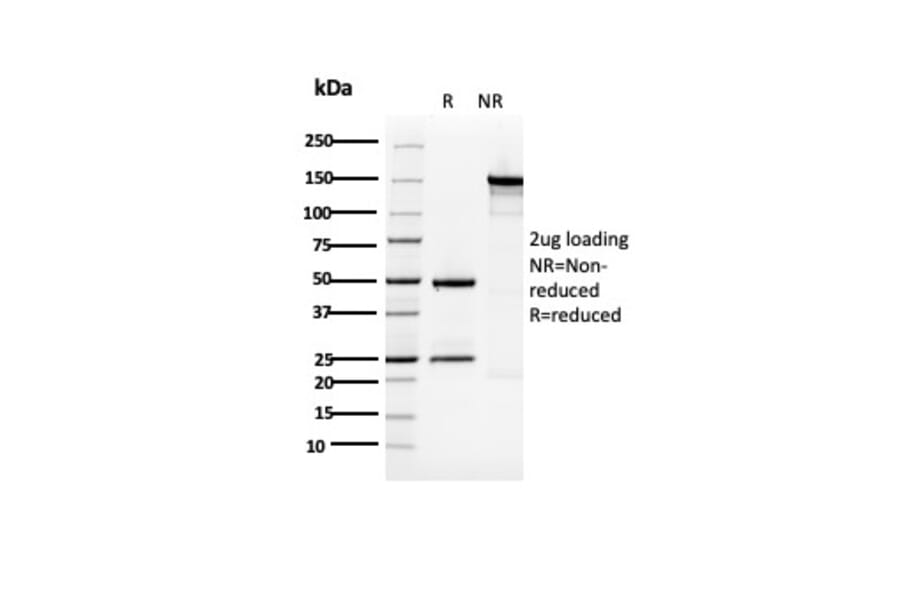 SDS-PAGE - Anti-Cytokeratin 5 Antibody [KRT5/3594] (A249124) - Antibodies.com