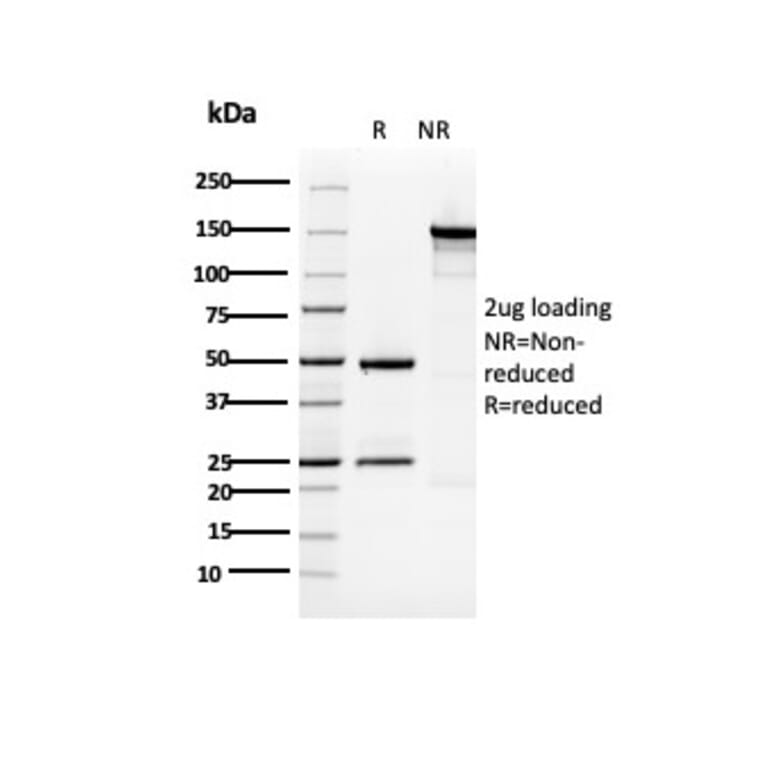 SDS-PAGE - Anti-Cytokeratin 5 Antibody [KRT5/3594] (A249124) - Antibodies.com