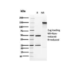 SDS-PAGE - Anti-Cytokeratin 5 Antibody [KRT5/3594] (A249124) - Antibodies.com