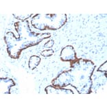 Immunohistochemistry - Anti-Cytokeratin 5 Antibody [rKRT5/6398] (A249125) - Antibodies.com